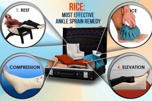 Metode RICE untuk Atasi Keseleo